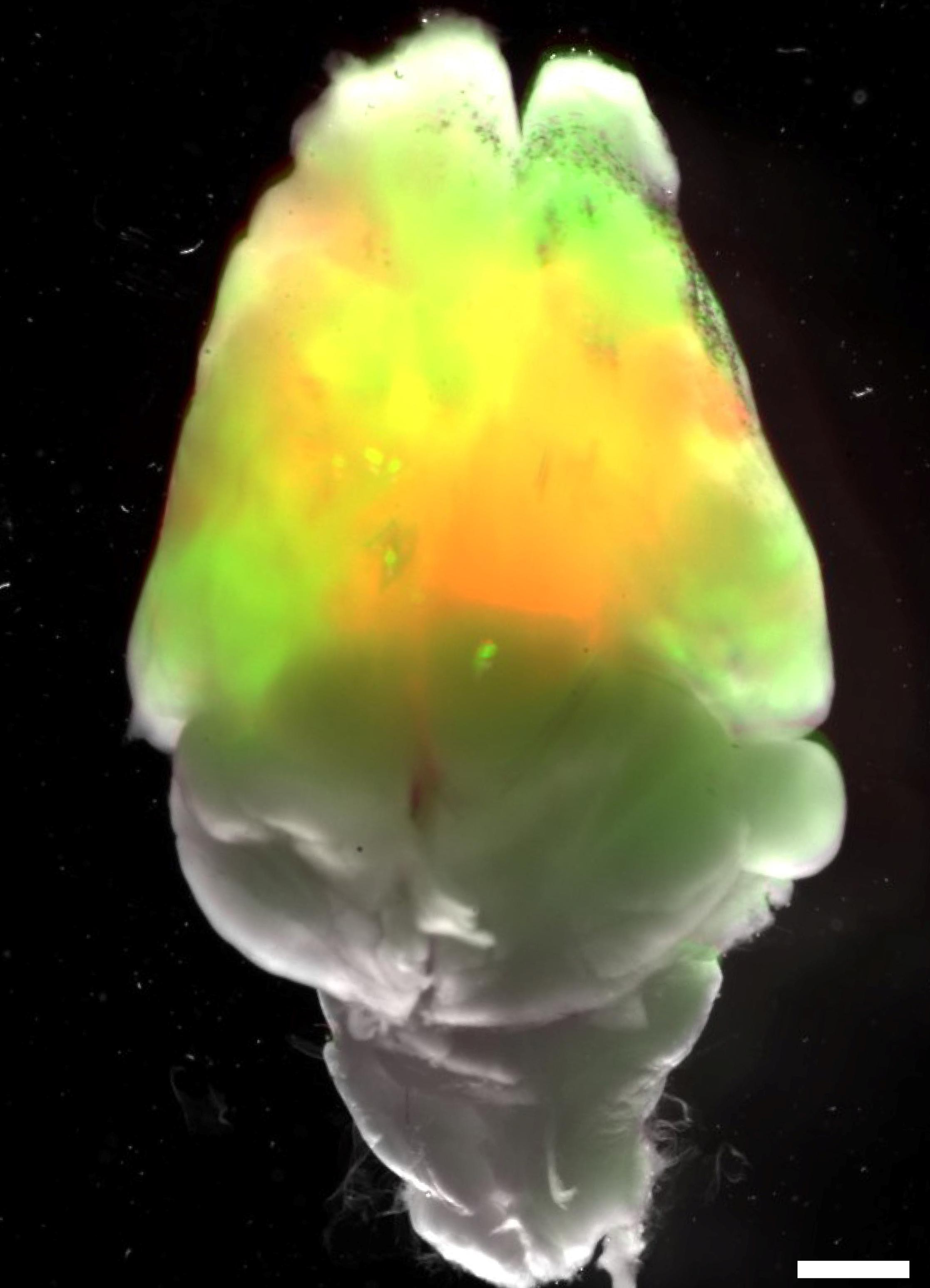 Top-down view of a xenocortical mouse brain grafted with human brain organoids that have been labeled in green and red before transplantation. 